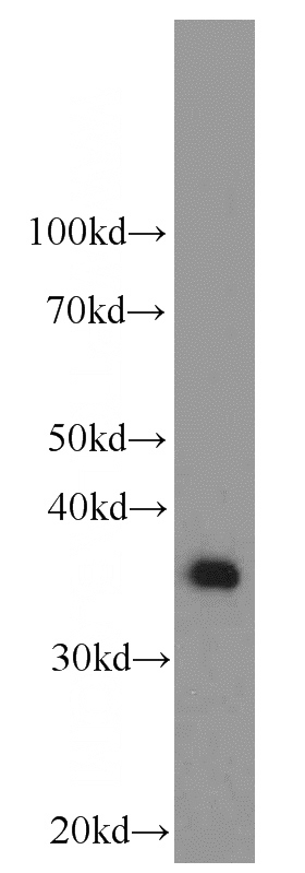 HepG2 cells were subjected to SDS PAGE followed by western blot with Catalog No:107406(ARG1 antibody) at dilution of 1:1000