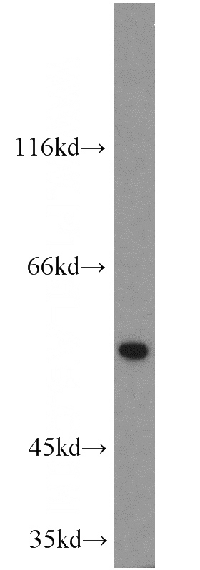 mouse testis tissue were subjected to SDS PAGE followed by western blot with Catalog No:109824(DDX25 antibody) at dilution of 1:500