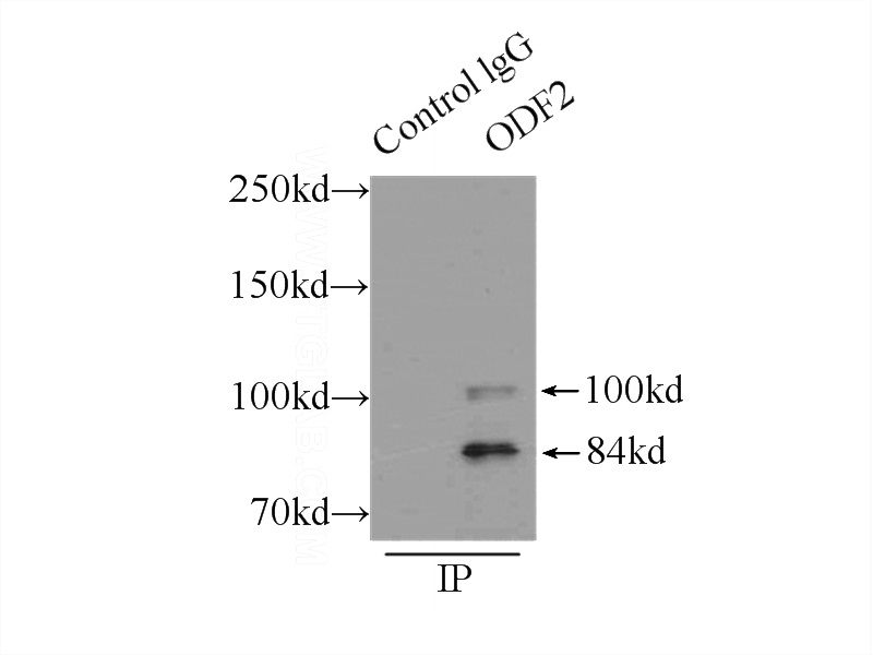 IP Result of anti-ODF2 (IP:Catalog No:113325, 5ug; Detection:Catalog No:113325 1:500) with mouse testis tissue lysate 8000ug.