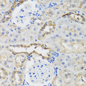 Immunohistochemistry - B9D1 Polyclonal Antibody 