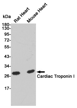 Western blot analysis of extracts from Rat and mouse heart tissue using Troponin I (168327,dilution 1:1000) Mouse mAb.Predicted band size:28kDa.Observed band size:28kDa.