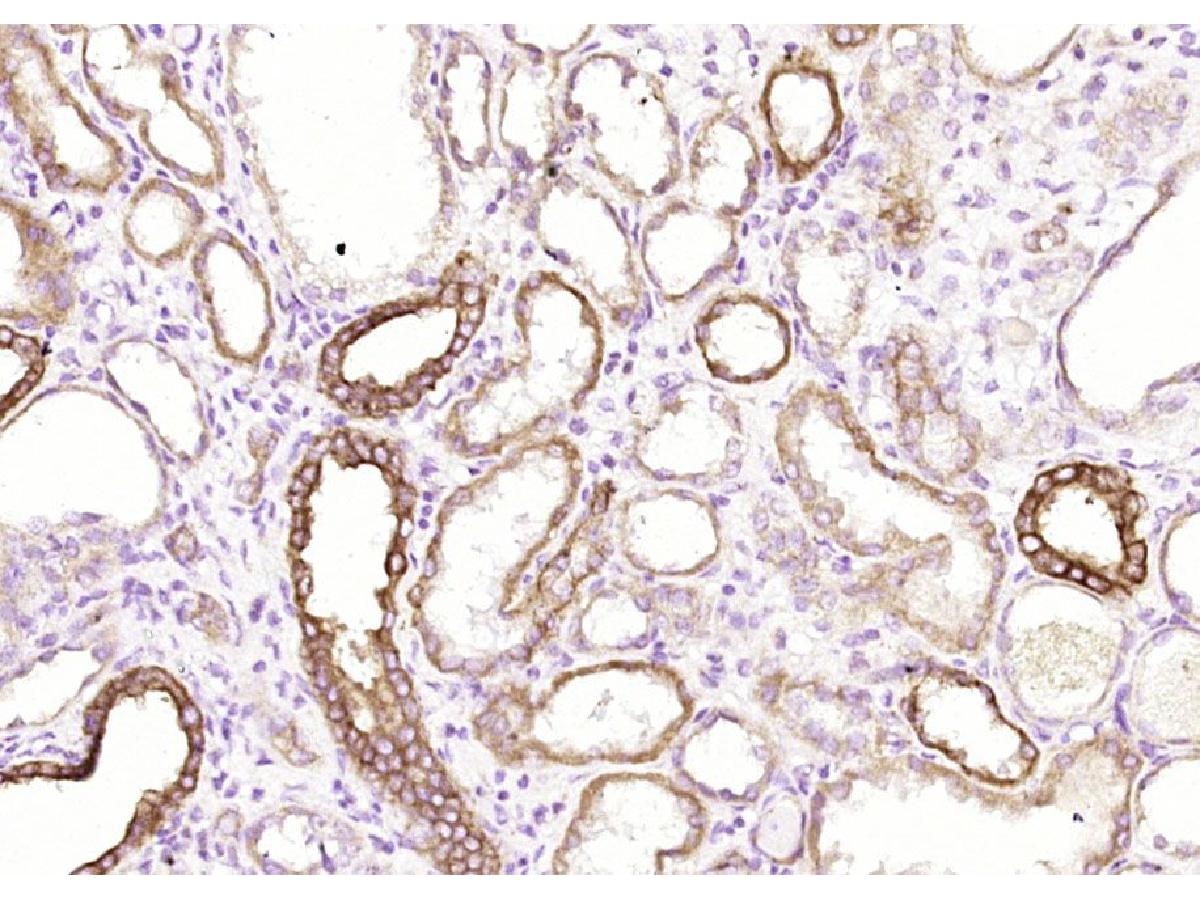 Fig7: Paraformaldehyde-fixed, paraffin embedded (Human kidney); Antigen retrieval by boiling in sodium citrate buffer (pH6.0) for 15min; Block endogenous peroxidase by 3% hydrogen peroxide for 20 minutes; Blocking buffer (normal goat serum) at 37℃ for 30m
