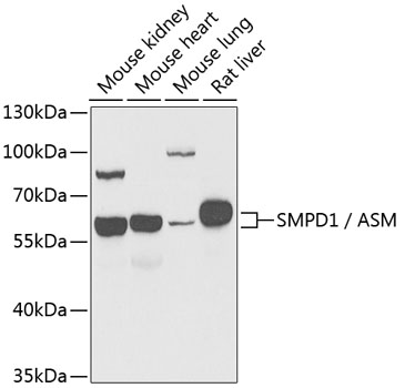 Western blot - SMPD1 / ASM Polyclonal Antibody 