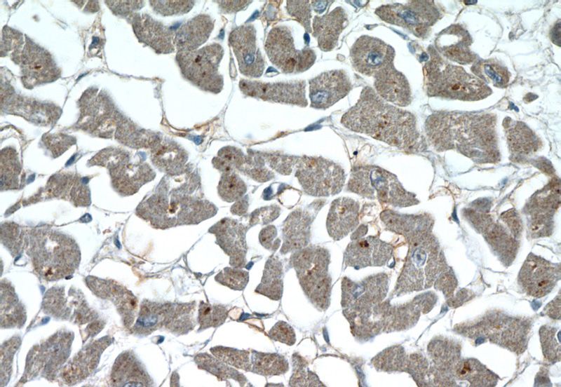 Immunohistochemistry of paraffin-embedded human heart tissue slide using Catalog No:113213(NPHP3 Antibody) at dilution of 1:50 (under 40x lens)