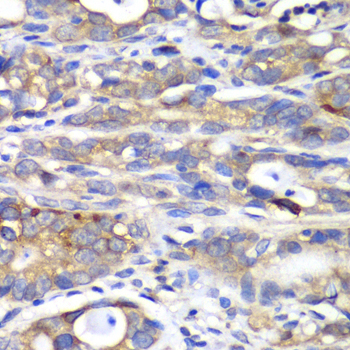 Immunohistochemistry - HAPLN1 Polyclonal Antibody 