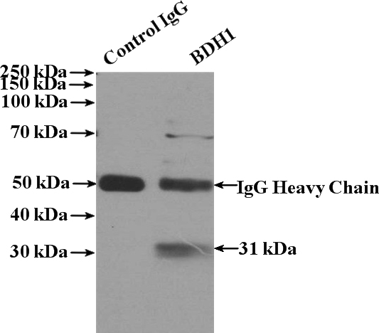 IP Result of anti-BDH1 (IP:Catalog No:117112, 4ug; Detection:Catalog No:117112 1:300) with mouse liver tissue lysate 4000ug.