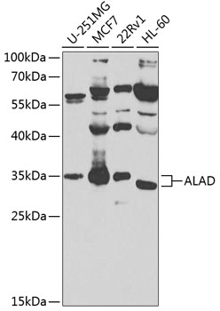 Western blot - ALAD Polyclonal Antibody 