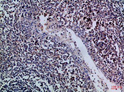 Fig1:; Immunohistochemical analysis of paraffin-embedded Human-tonsil, antibody was diluted at 1:100