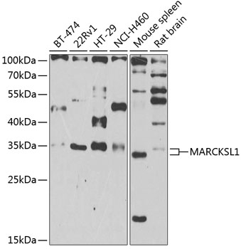Western blot - MARCKSL1 Polyclonal Antibody 