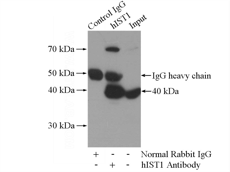 IP Result of anti-hIST1 (IP:Catalog No:111358, 4ug; Detection:Catalog No:111358 1:1000) with mouse liver tissue lysate 4000ug.