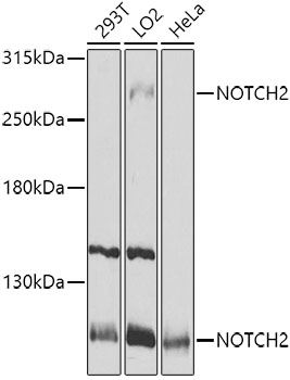 Western blot - NOTCH2 Polyclonal Antibody 