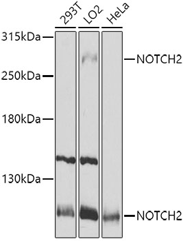 Western blot - NOTCH2 Polyclonal Antibody 