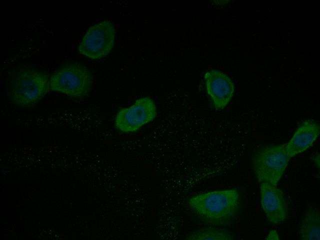Fig2:; ICC staining of TMEM163 in 293 cells (green). Formalin fixed cells were permeabilized with 0.1% Triton X-100 in TBS for 10 minutes at room temperature and blocked with 1% Blocker BSA for 15 minutes at room temperature. Cells were probed with the primary antibody ( 1/100) for 1 hour at room temperature, washed with PBS. Alexa Fluor®488 Goat anti-Rabbit IgG was used as the secondary antibody at 1/1,000 dilution. The nuclear counter stain is DAPI (blue).