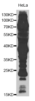 Western blot - Pan Acetyl-Lysine pAb 
