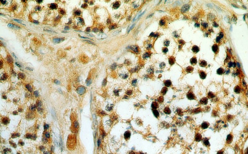 Immunohistochemical of paraffin-embedded human testis using Catalog No:115130(SETDB1 antibody) at dilution of 1:50 (under 40x lens)
