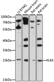 Western blot - KLK6 Polyclonal Antibody 