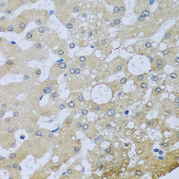 Immunohistochemistry - UQCR10 Polyclonal Antibody 