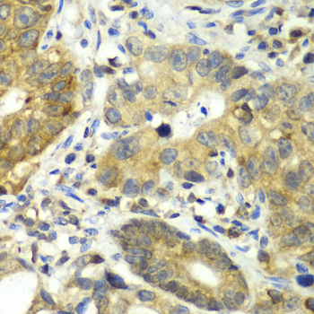 Immunohistochemistry - DPP3 Polyclonal Antibody 