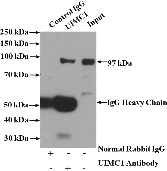IP Result of anti-UIMC1 (IP:Catalog No:116565, 4ug; Detection:Catalog No:116565 1:500) with COLO 320 cells lysate 2400ug.