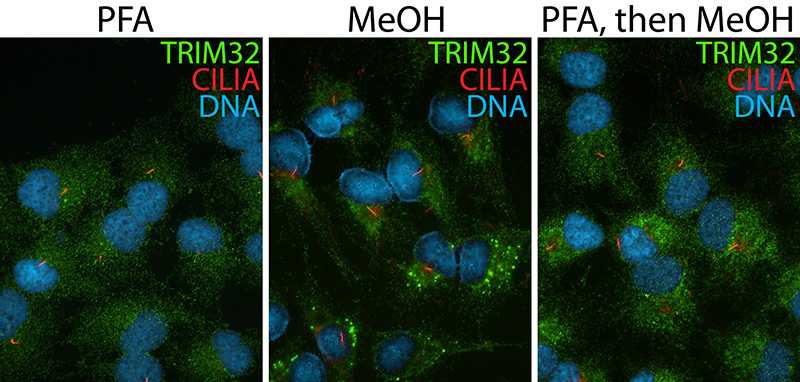 IF result (cytoplasm stain) of anti-BBS11 (Catalog No:116311; 1:50) with hTERT-RPE1 cell by Dr. Moshe Kim.