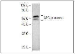 Fig1: Western blot analysis of OPG monomer expression in rat bone marrow extract.
