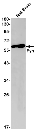 Western blot detection of Fyn in Rat Brain lysates using Fyn Rabbit pAb(1:1000 diluted).Predicted band size:61kDa.Observed band size:61kDa.