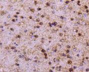 Fig6:; Immunohistochemical analysis of paraffin-embedded mouse brain tissue using anti-PPP1R1A antibody. The section was pre-treated using heat mediated antigen retrieval with Tris-EDTA buffer (pH 9.0) for 20 minutes.The tissues were blocked in 1% BSA for 30 minutes at room temperature, washed with ddH; 2; O and PBS, and then probed with the primary antibody ( 1/50) for 30 minutes at room temperature. The detection was performed using an HRP conjugated compact polymer system. DAB was used as the chromogen. Tissues were counterstained with hematoxylin and mounted with DPX.