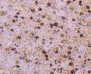Fig6:; Immunohistochemical analysis of paraffin-embedded mouse brain tissue using anti-PPP1R1A antibody. The section was pre-treated using heat mediated antigen retrieval with Tris-EDTA buffer (pH 9.0) for 20 minutes.The tissues were blocked in 1% BSA for 30 minutes at room temperature, washed with ddH; 2; O and PBS, and then probed with the primary antibody ( 1/50) for 30 minutes at room temperature. The detection was performed using an HRP conjugated compact polymer system. DAB was used as the chromogen. Tissues were counterstained with hematoxylin and mounted with DPX.