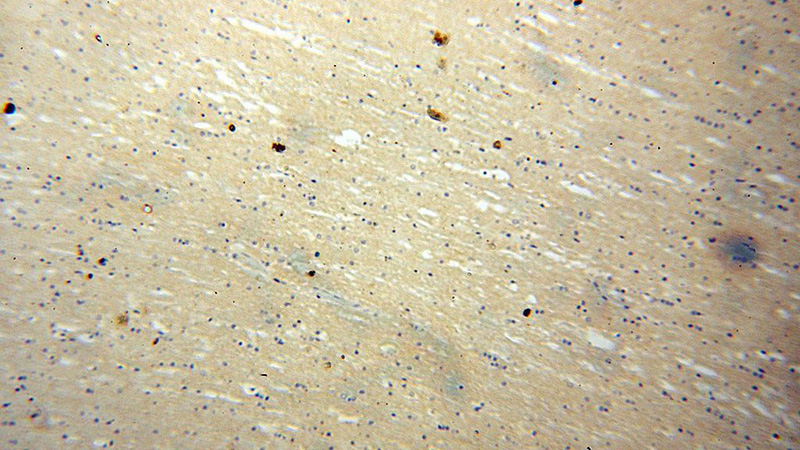 Immunohistochemical of paraffin-embedded human brain using Catalog No:116742(VEZT antibody) at dilution of 1:100 (under 10x lens)