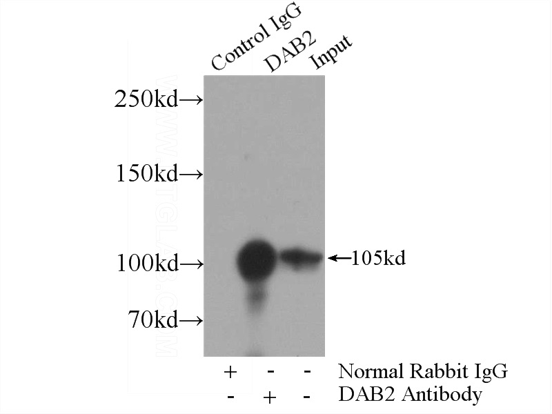 IP Result of anti-DAB2 (IP:Catalog No:109851, 4ug; Detection:Catalog No:109851 1:2000) with HeLa cells lysate 4000ug.