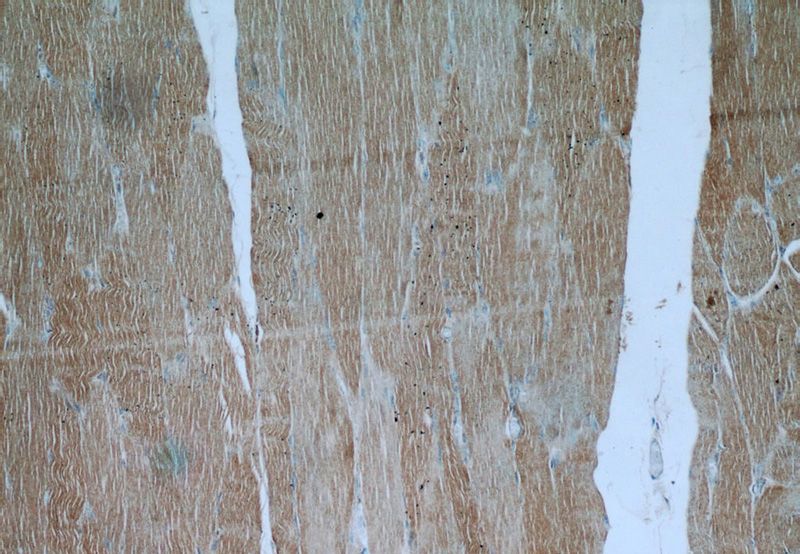 Immunohistochemical of paraffin-embedded human skeletal muscle using Catalog No:110571(FAM13A antibody) at dilution of 1:50 (under 10x lens)