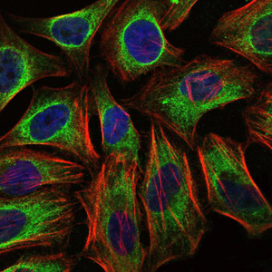 Immunofluorescence analysis of Hela cells using C-CBL mouse mAb (green). Blue