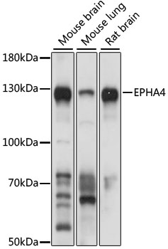 Western blot - EPHA4 Polyclonal Antibody 