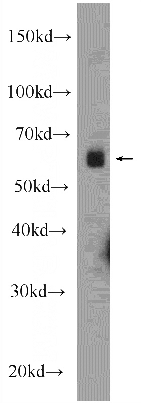 mouse brain tissue were subjected to SDS PAGE followed by western blot with Catalog No:110153(E2F1 Antibody) at dilution of 1:300