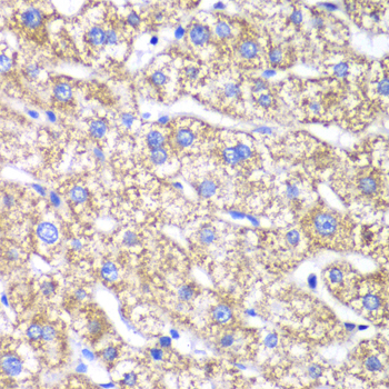 Immunohistochemistry - DLST Polyclonal Antibody 