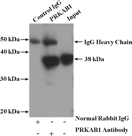 IP Result of anti-PRKAB1 (IP:Catalog No:108008, 4ug; Detection:Catalog No:108008 1:1000) with mouse liver tissue lysate 4000ug.