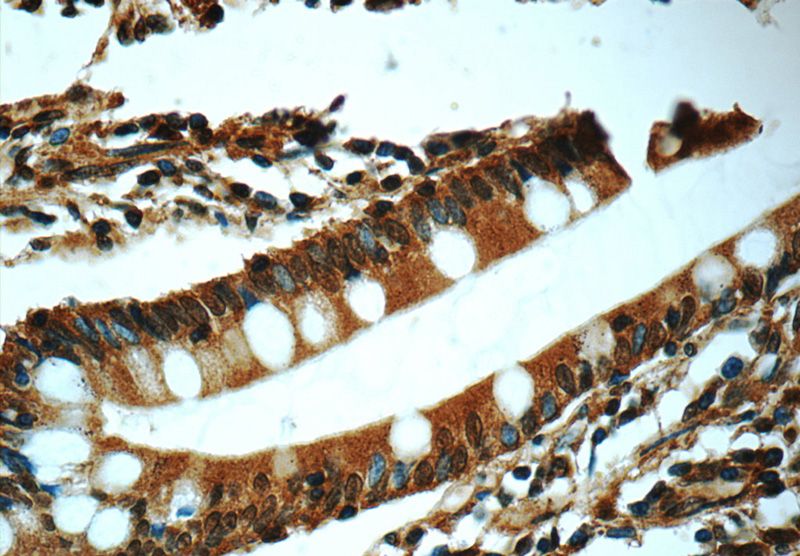 Immunohistochemistry of paraffin-embedded human small intestine tissue slide using Catalog No:107154(CHK1 Antibody) at dilution of 1:50 (under 40x lens)