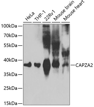 Western blot - CAPZA2 Polyclonal Antibody 