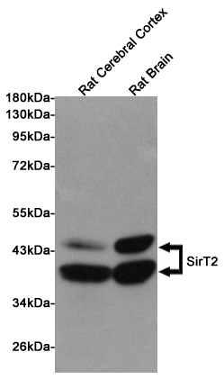 Western blot detection of SirT2 in Rat Cerebral Cortex and Rat Brain lysates using SirT2 mouse mAb (1:1000 diluted). Predicted band size: 39,43KDa. Observed band size:39,43KDa.