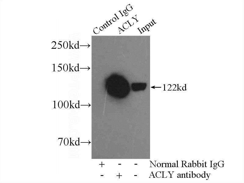 IP Result of anti-ACLY (IP:Catalog No:108336, 4ug; Detection:Catalog No:108336 1:1000) with K-562 cells lysate 3200ug.