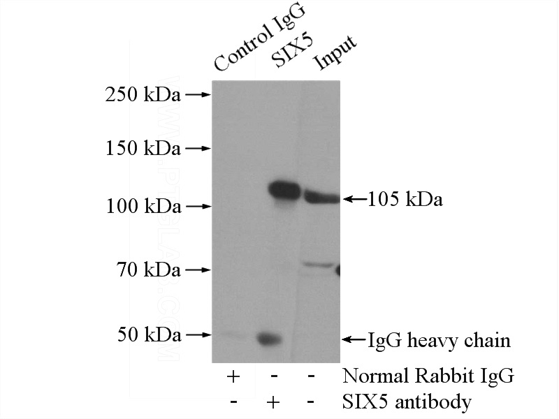 IP Result of anti-SIX5 (IP:Catalog No:115252, 4ug; Detection:Catalog No:115252 1:300) with Y79 cells lysate 2000ug.