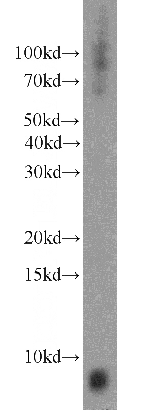 human brain tissue were subjected to SDS PAGE followed by western blot with Catalog No:111788(INE1 antibody) at dilution of 1:300