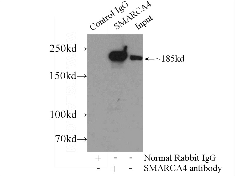 IP Result of anti-SMARCA4 (IP:Catalog No:115427, 5ug; Detection:Catalog No:115427 1:1000) with HeLa cells lysate 2500ug.