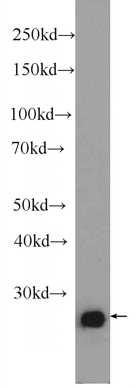 Neuro-2a cells were subjected to SDS PAGE followed by western blot with Catalog No:108668(C15orf29 Antibody) at dilution of 1:600