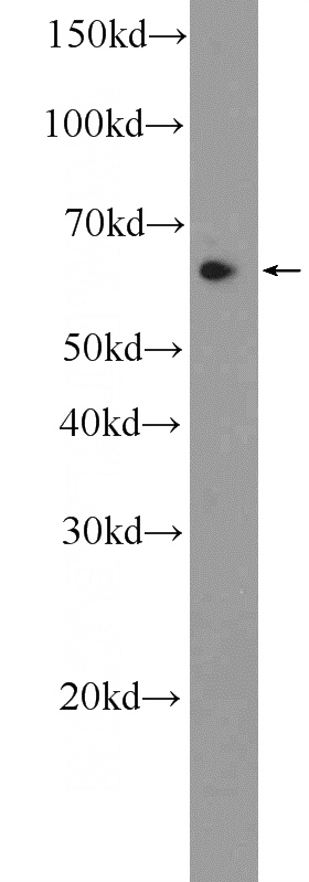 HeLa cells were subjected to SDS PAGE followed by western blot with Catalog No:108958(CCDC102A Antibody) at dilution of 1:1000