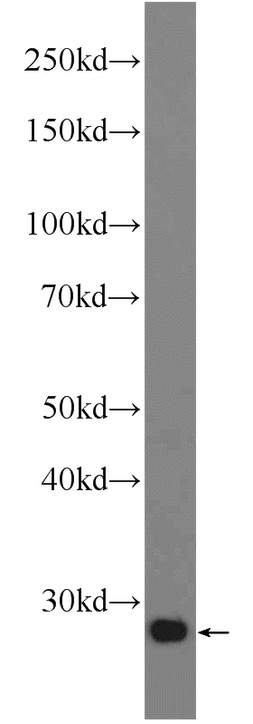 human placenta tissue were subjected to SDS PAGE followed by western blot with Catalog No:108668(C15orf29 Antibody) at dilution of 1:600