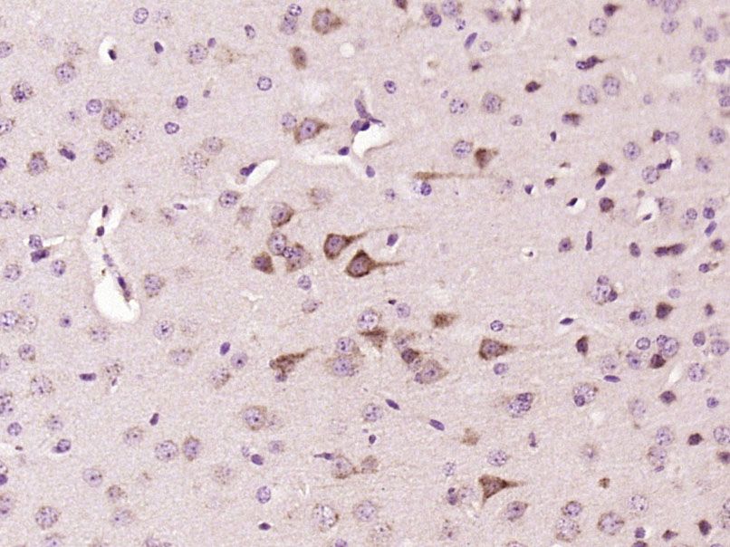 Fig1: Paraformaldehyde-fixed, paraffin embedded (Mouse brain); Antigen retrieval by boiling in sodium citrate buffer (pH6.0) for 15min; Block endogenous peroxidase by 3% hydrogen peroxide for 20 minutes; Blocking buffer (normal goat serum) at 37℃ for 30min; Antibody incubation with (FSD1) Polyclonal Antibody, Unconjugated at 1:400 overnight at 4℃, followed by operating according to SP Kit(Rabbit) (sp-0023) instructionsand DAB staining.
