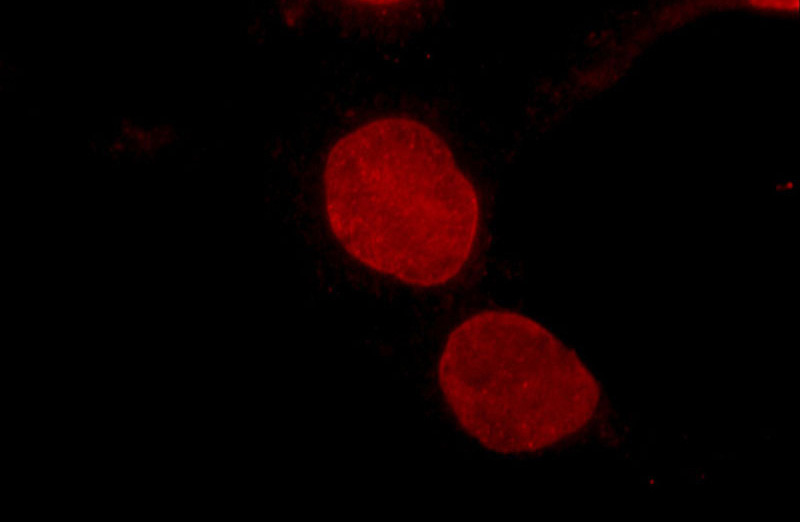Immunofluorescent analysis of COS-7 cells using Catalog No:107019(BMI1 Antibody) at dilution of 1:25 and Rhodamine-Goat anti-Mouse IgG