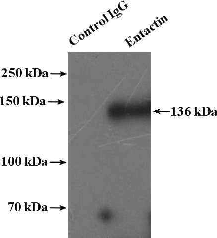 IP Result of anti-NID1 (IP:Catalog No:110329, 4ug; Detection:Catalog No:110329 1:200) with human placenta tissue lysate 4000ug.