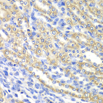 Immunohistochemistry - SURF1 Polyclonal Antibody 